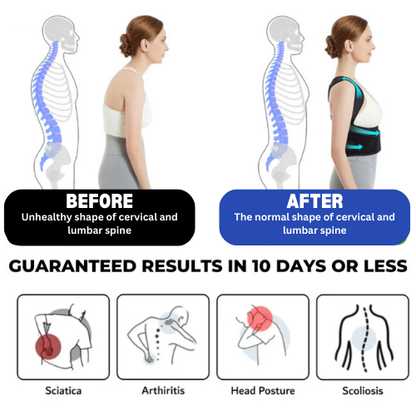 BubyWear ™ Posture Corrector + FREE GIFT 🎁